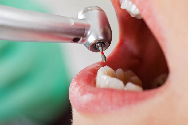 Best Emergency Dental Care for Trauma or Injury in Manor, TX